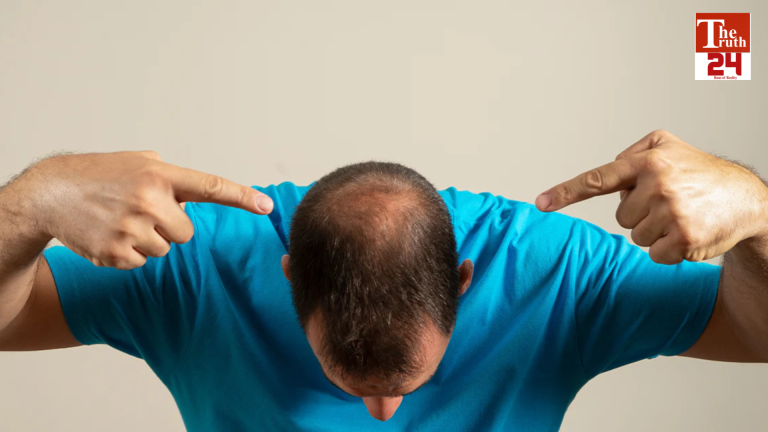 GREATER NOIDA BALD HUSBAND NEWS