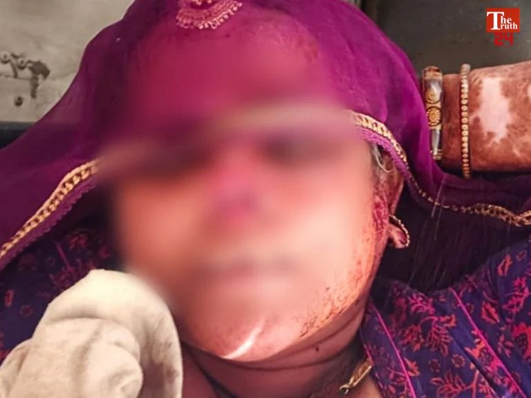 son in law cuts mother in law nose