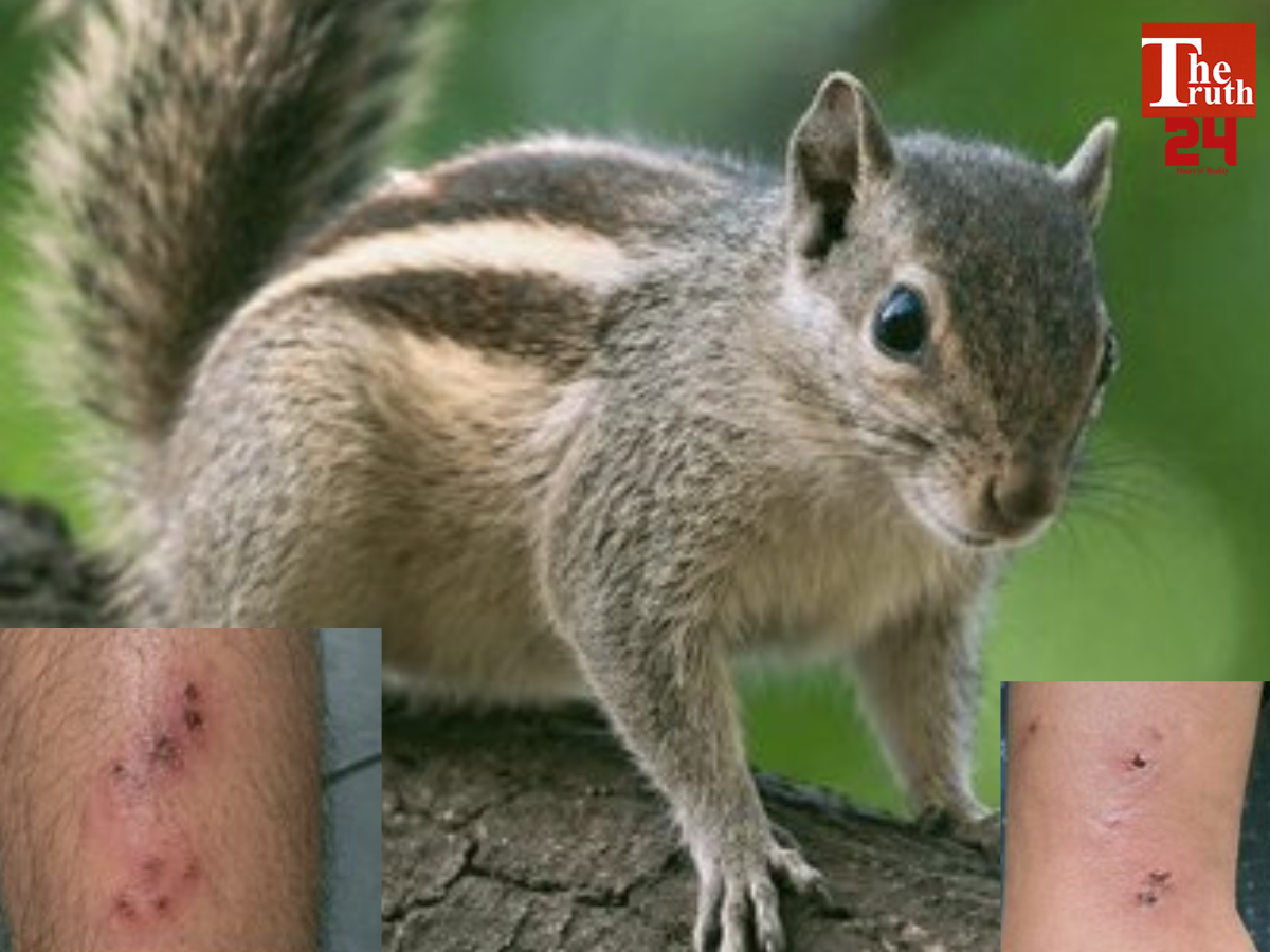 mlsu squirrel attack 20 people bitten udaipur