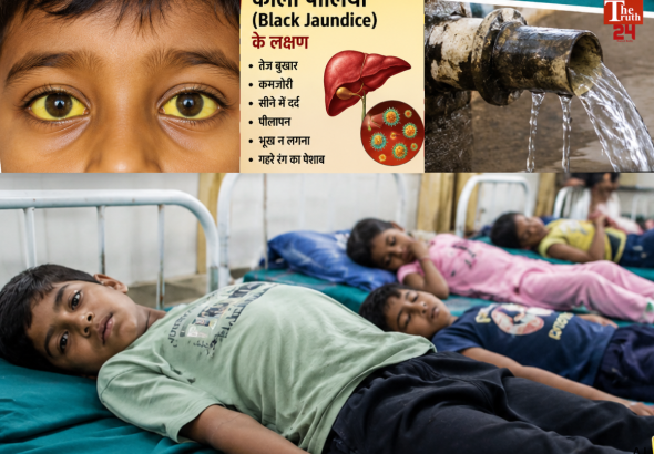Black jaundice wreaks havoc in Uttarakhand 40 children fall ill simultaneously one dies (1)
