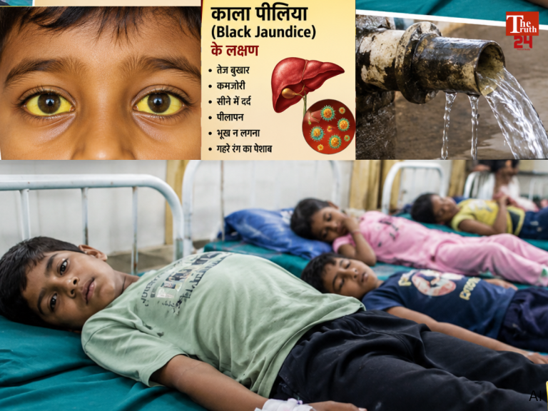 Black jaundice wreaks havoc in Uttarakhand 40 children fall ill simultaneously one dies (1)